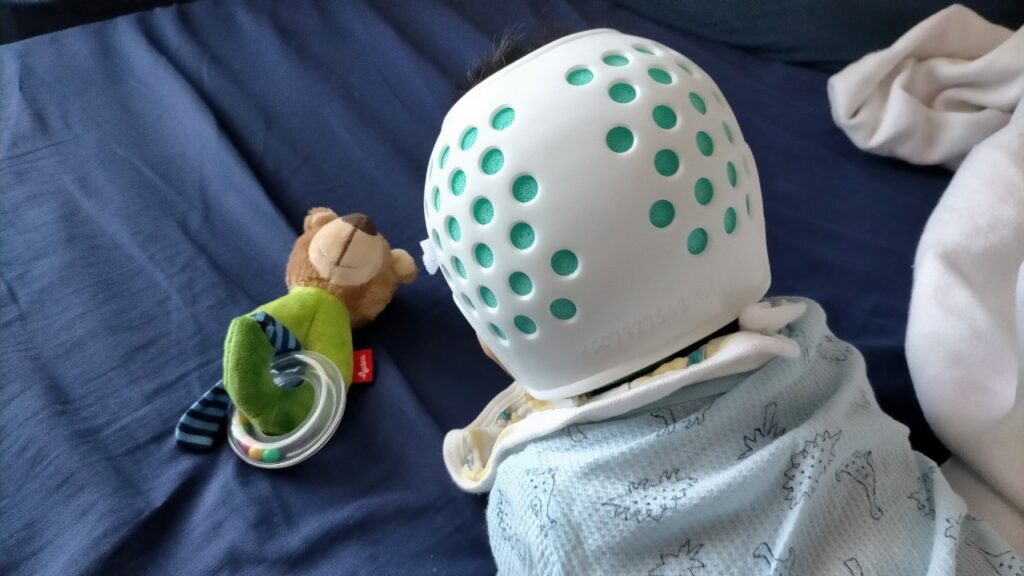 医療用ヘルメットと赤ちゃん