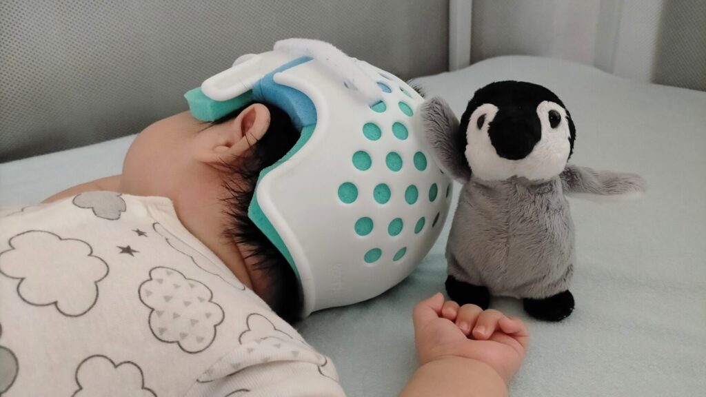 ペンギンのぬいぐるみとヘルメット治療をする赤ちゃん